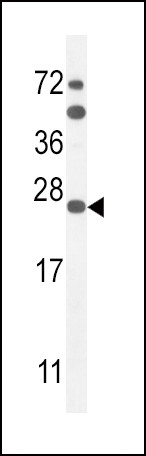 SCN1B Antibody in Western Blot (WB)