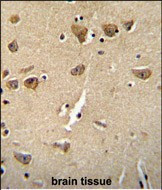 CPLX3 Antibody in Immunohistochemistry (Paraffin) (IHC (P))