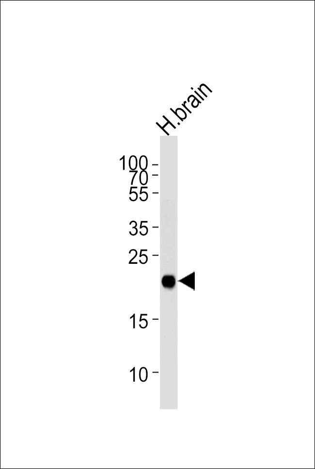 CPLX3 Antibody in Western Blot (WB)