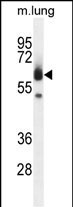 ZUFSP Antibody in Western Blot (WB)