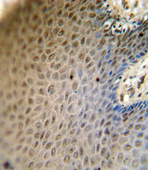 SREBP2 Antibody in Immunohistochemistry (Paraffin) (IHC (P))