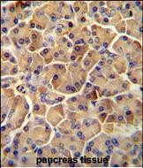 SEL1L Antibody in Immunohistochemistry (Paraffin) (IHC (P))