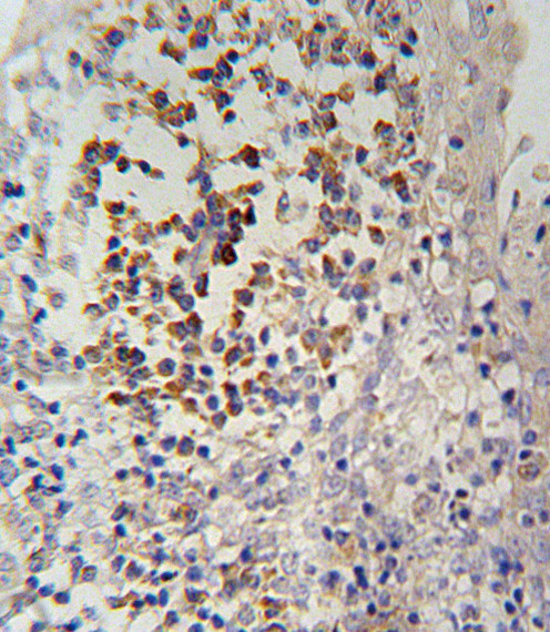 IL12RB2 Antibody in Immunohistochemistry (Paraffin) (IHC (P))