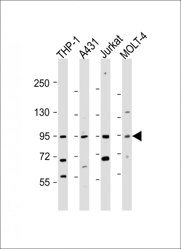 IL12RB2 Antibody in Western Blot (WB)