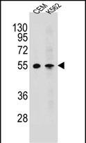 MCHR1 Antibody in Western Blot (WB)