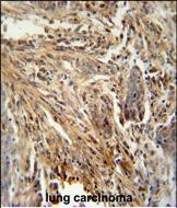 GM-CSF Antibody in Immunohistochemistry (Paraffin) (IHC (P))