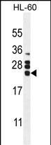 GM-CSF Antibody in Western Blot (WB)