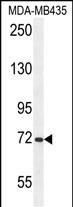 ARHGAP10 Antibody in Western Blot (WB)