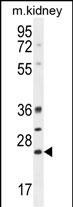 Bcl-10 Antibody in Western Blot (WB)