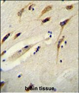 BEX1 Antibody in Immunohistochemistry (Paraffin) (IHC (P))