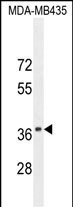 CADM1 Antibody in Western Blot (WB)