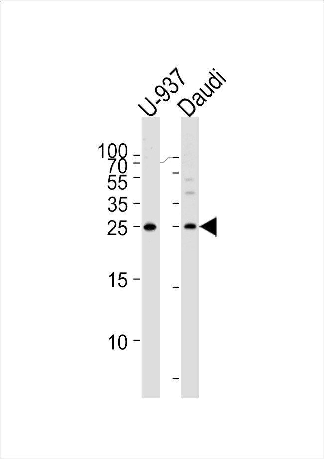 CD37 Antibody in Western Blot (WB)