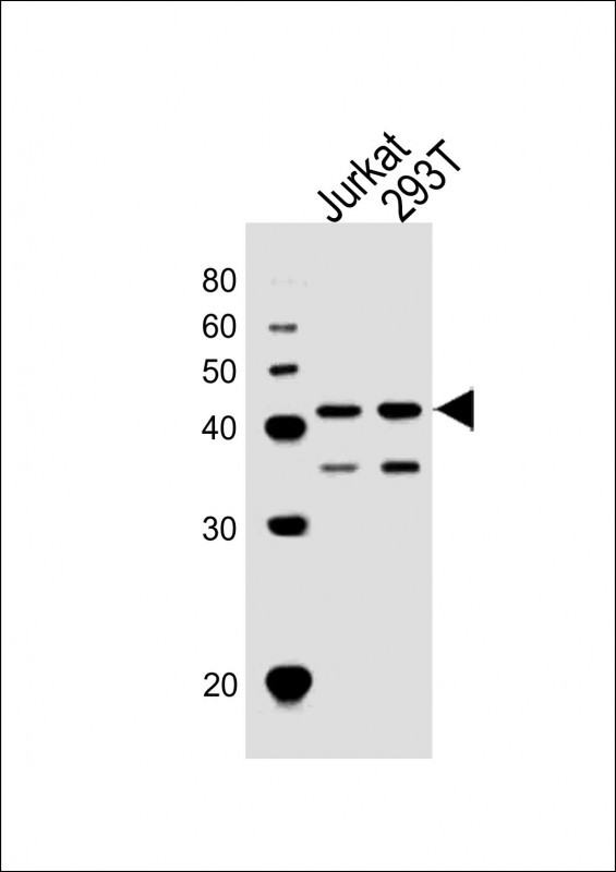 ETS1 Antibody in Western Blot (WB)