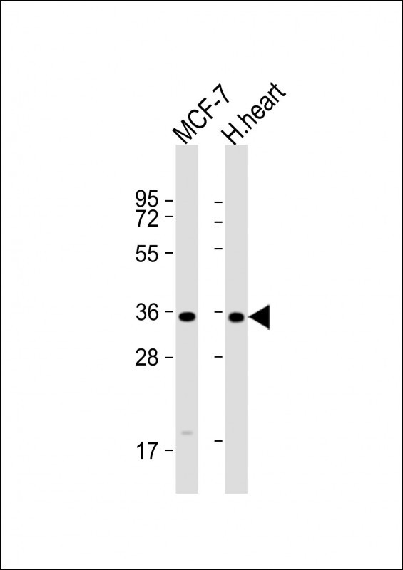 GPD1L Antibody in Western Blot (WB)