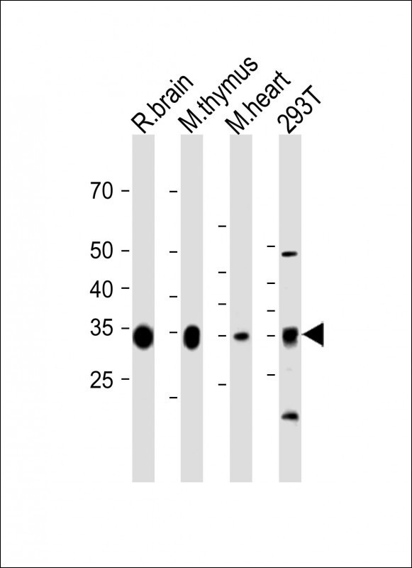 GPD1L Antibody in Western Blot (WB)