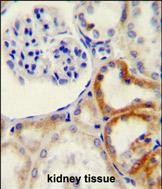 HYAL2 Antibody in Immunohistochemistry (Paraffin) (IHC (P))