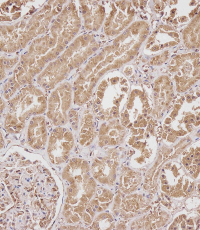 SERPINA6 Antibody in Immunohistochemistry (Paraffin) (IHC (P))