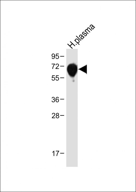 SERPINA6 Antibody in Western Blot (WB)