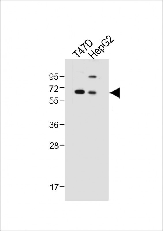 SERPINA6 Antibody in Western Blot (WB)