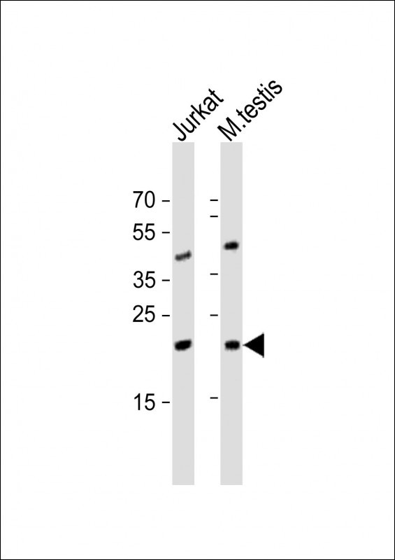 ORMDL3 Antibody in Western Blot (WB)