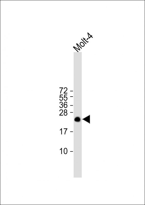 ORMDL3 Antibody in Western Blot (WB)