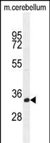 TMEM66 Antibody in Western Blot (WB)