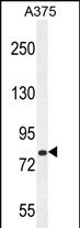 WDPCP Antibody in Western Blot (WB)