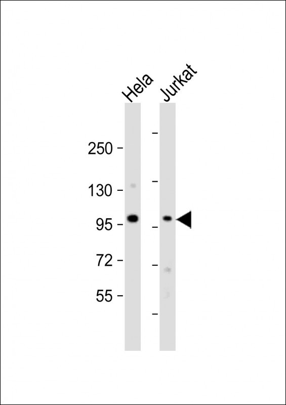 NSUN2 Antibody in Western Blot (WB)