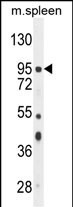 NSUN2 Antibody in Western Blot (WB)