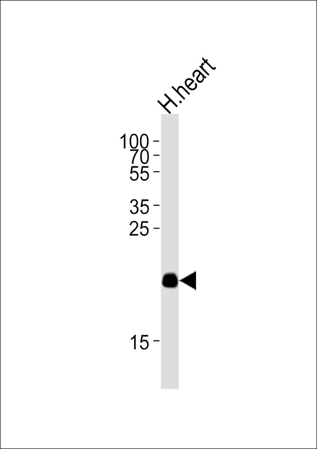 ORMDL2 Antibody in Western Blot (WB)