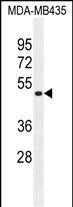 TAPT1 Antibody in Western Blot (WB)