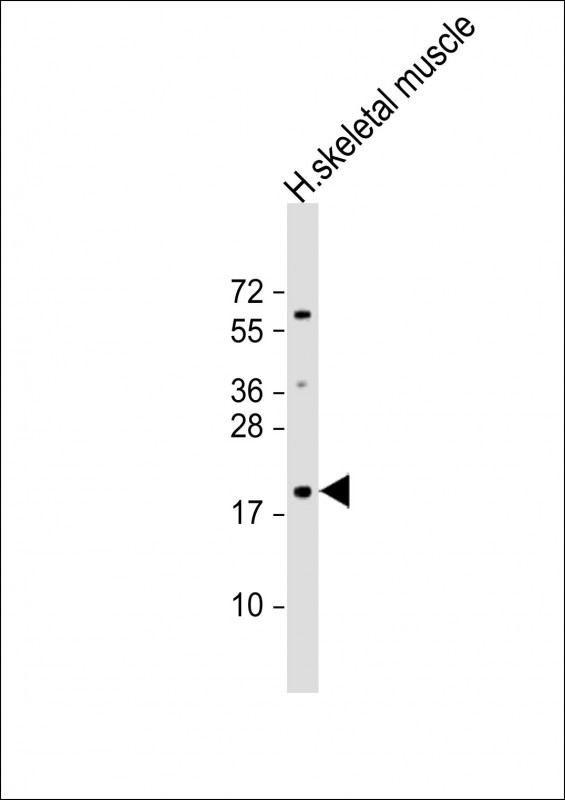 IMMP1L Antibody in Western Blot (WB)