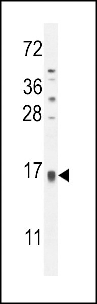 TCL6 Antibody in Western Blot (WB)