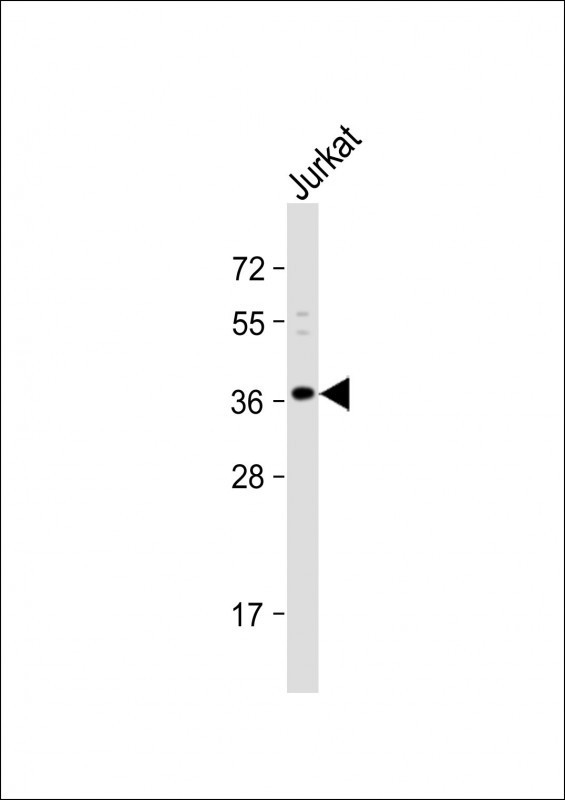 OR8B8 Antibody in Western Blot (WB)