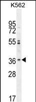 OR2M3 Antibody in Western Blot (WB)