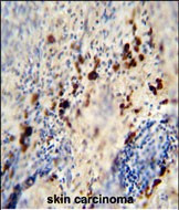 LCE1A Antibody in Immunohistochemistry (Paraffin) (IHC (P))