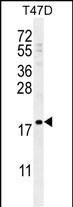 LCE1A Antibody in Western Blot (WB)