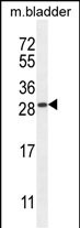 TIFAB Antibody in Western Blot (WB)