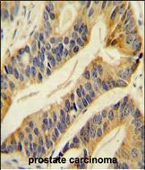 SLC16A11 Antibody in Immunohistochemistry (Paraffin) (IHC (P))