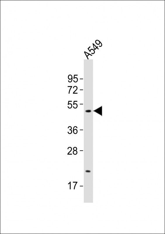 SLC16A11 Antibody in Western Blot (WB)