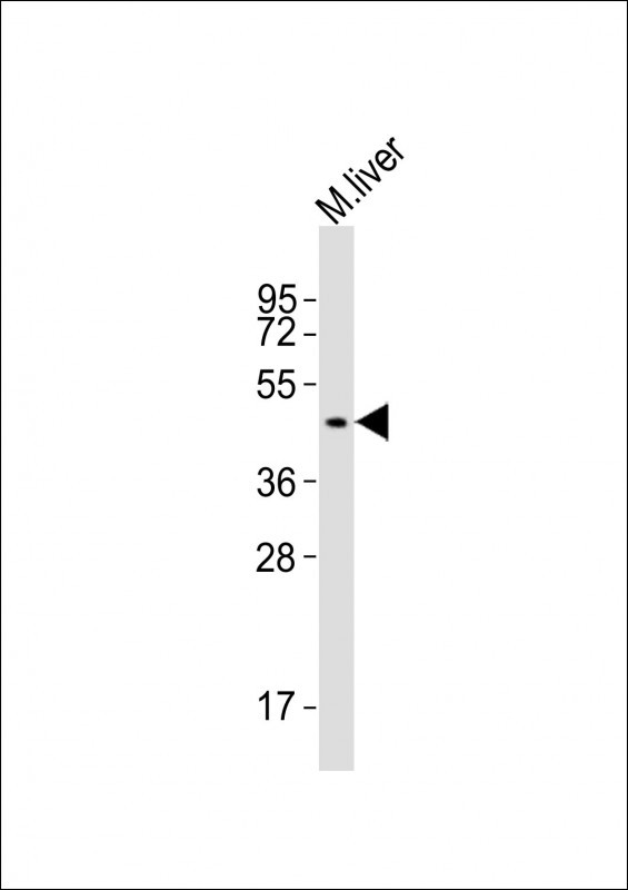 SLC16A11 Antibody in Western Blot (WB)