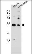 SLC16A11 Antibody in Western Blot (WB)