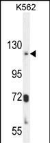 ATP8A2 Antibody in Western Blot (WB)