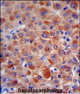 Complement Factor H Antibody in Immunohistochemistry (Paraffin) (IHC (P))