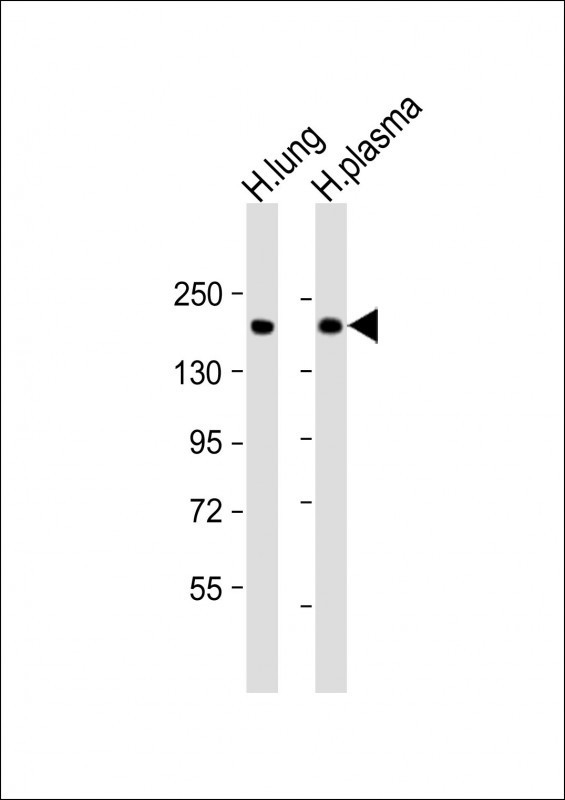 Complement Factor H Antibody in Western Blot (WB)