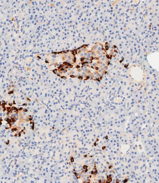 Apolipoprotein J Antibody in Immunohistochemistry (Paraffin) (IHC (P))