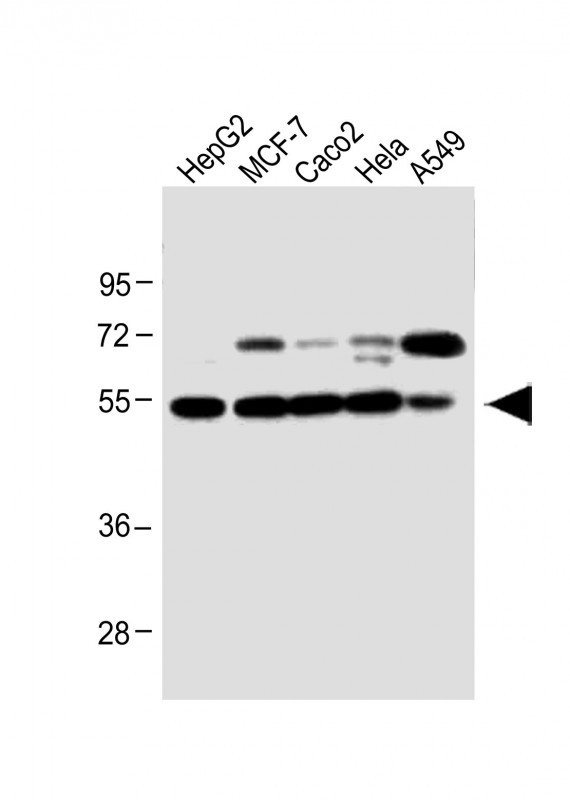 Apolipoprotein J Antibody in Western Blot (WB)