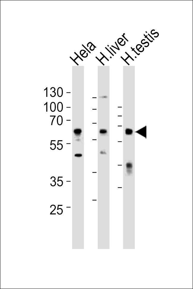 Apolipoprotein J Antibody in Western Blot (WB)