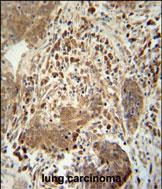 TAGAP Antibody in Immunohistochemistry (Paraffin) (IHC (P))