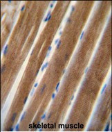 TNIP1 Antibody in Immunohistochemistry (Paraffin) (IHC (P))